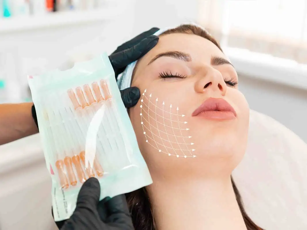 What is the Best Age for PDO Threadlift Treatment by Afzal Clinics in Edina, MN and Fridley,MN