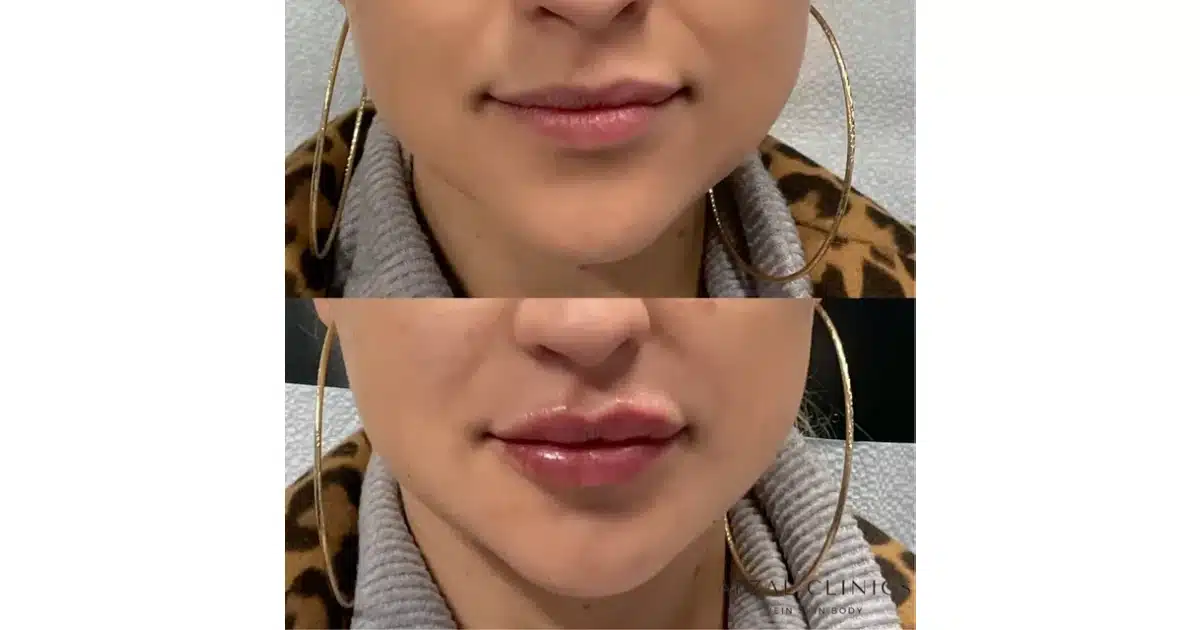 Afzal Clinics before & after