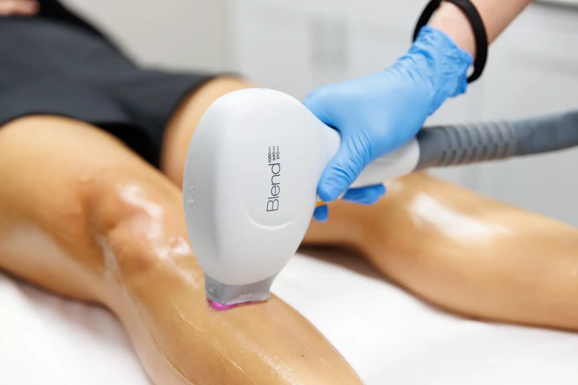 Laser Hair Removal in Fridley and Edina MN Afzal Clinics