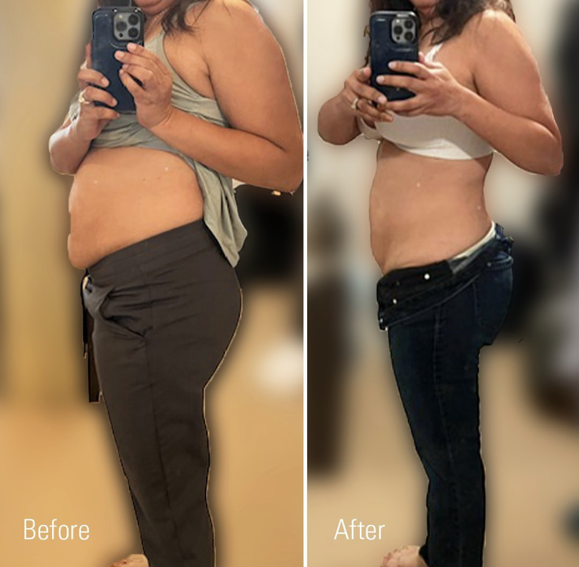 Before and after medical weight loss results