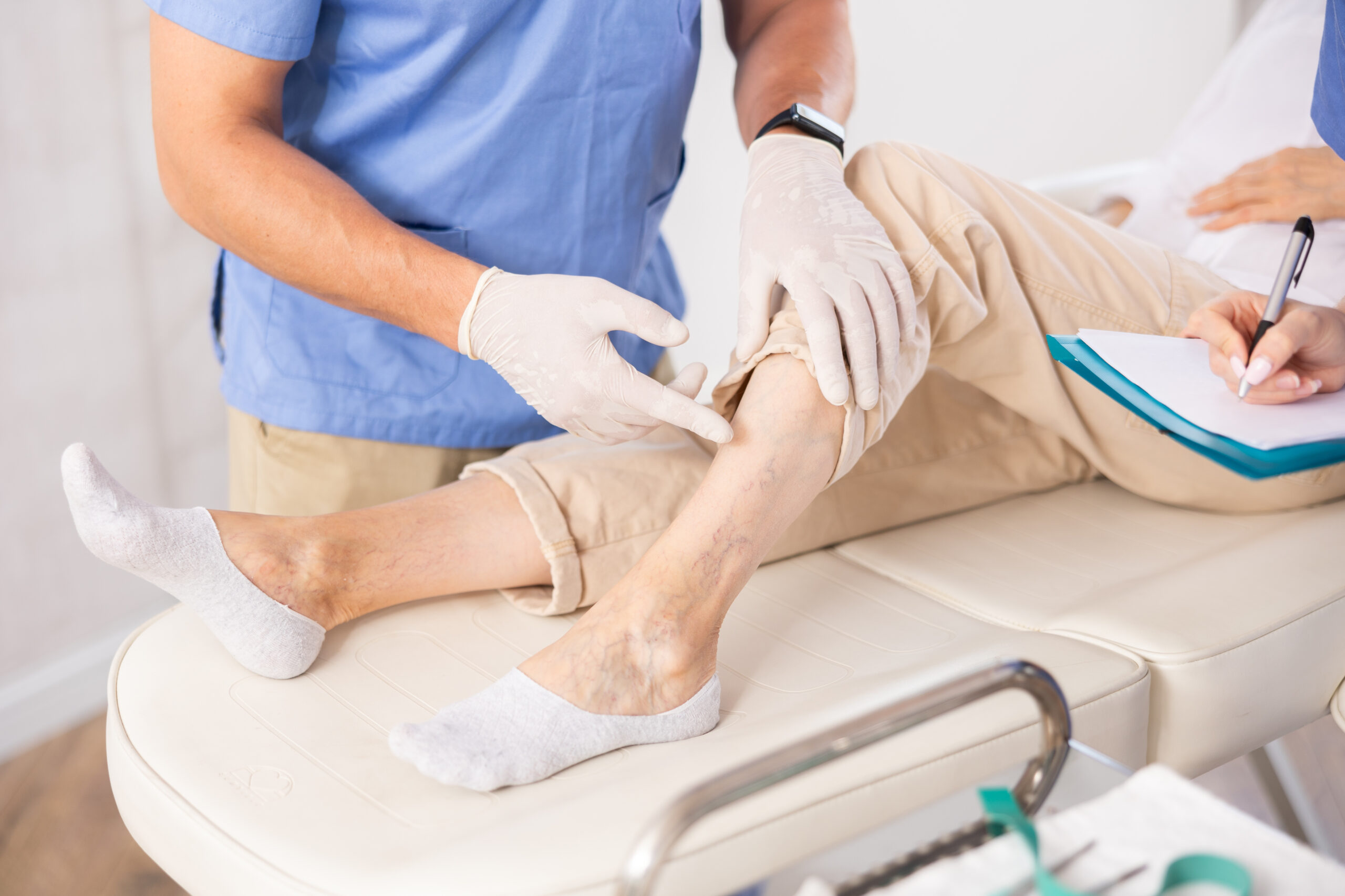 Sclerotherapy for Spider veins by Afzal Clinics in Edina, MN