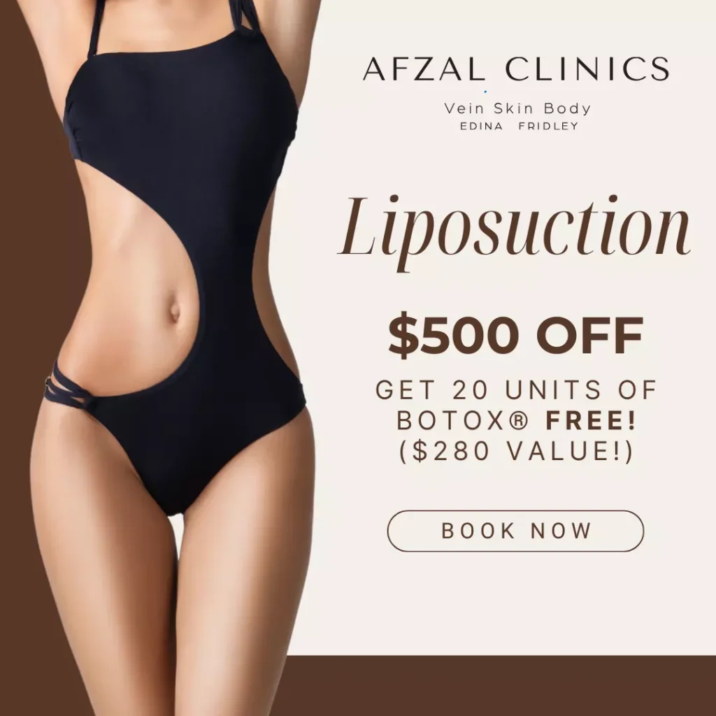 Banner of Afzal Clinics Liposuction Offer