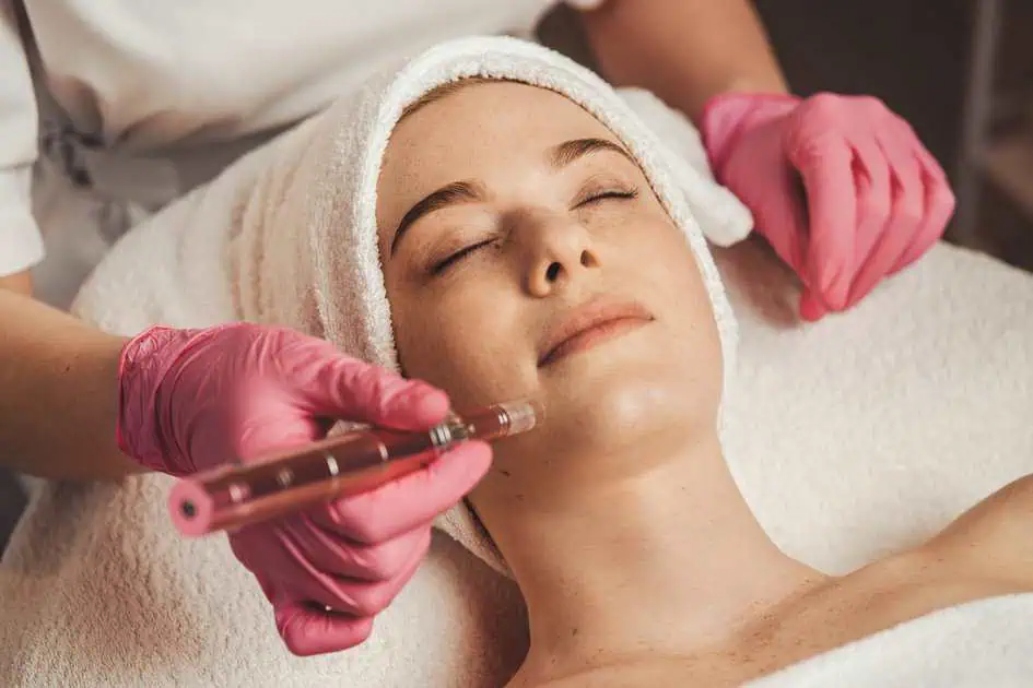 SkinPen Microneedling in ,Edina, MN by Afzal Clinics