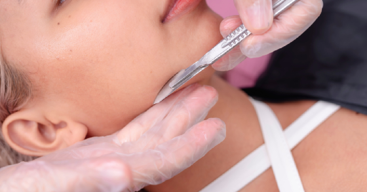 Aesthetician performing a gentle dermaplaning treatment on a woman's face in in Las Vegas, NV