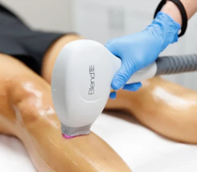 Laser Hair Removal by Afzal Clinics in Edina, MN and Fridley, MN